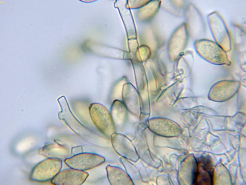 Botryobasidium aureum 10 - Conidióforos-006